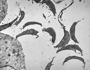 Giardia (Lamblia) intestinalis Giardia (Lamblia) intestinalis